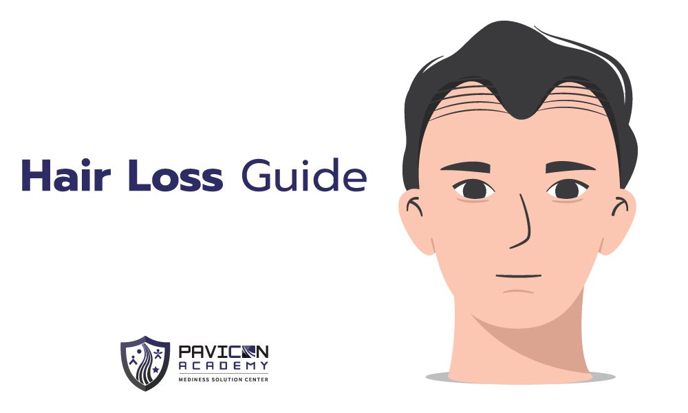 Hair Loss Guide - Pavicon Mediness Center